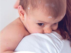 Evolución de la microbiota en los primero 1,000 días de vida