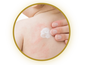 Lactantes en riesgo de hiperreactividad del sistema inmunitario