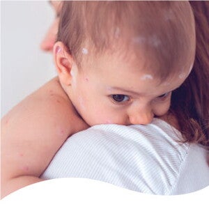 Evolución de la microbiota en los primero 1,000 días de vida