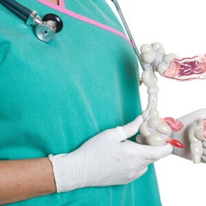 Medico con un modelo de intestino grueso
