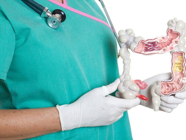 Medico con un modelo de intestino grueso