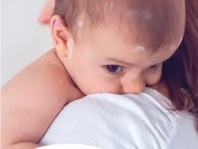 Evolución de la microbiota en los primero 1,000 días de vida