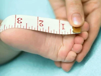 Medico midiendo el pie de un bebe